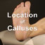 Calluses