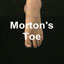 MortonsToe